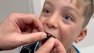 How to Pull a Loose Tooth 🦷 Losing a Baby Tooth 😁 Health Stories