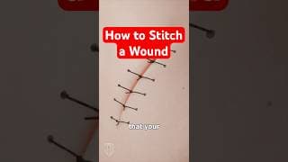 Science Behind Stitches Explained & How Sutures Work #medical #medicalstudent #nursingstudent
