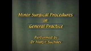 Minor Surgical Procedures in General Practice