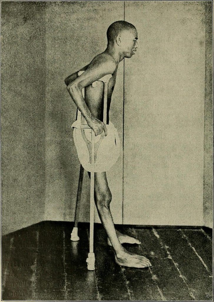 Article illustration